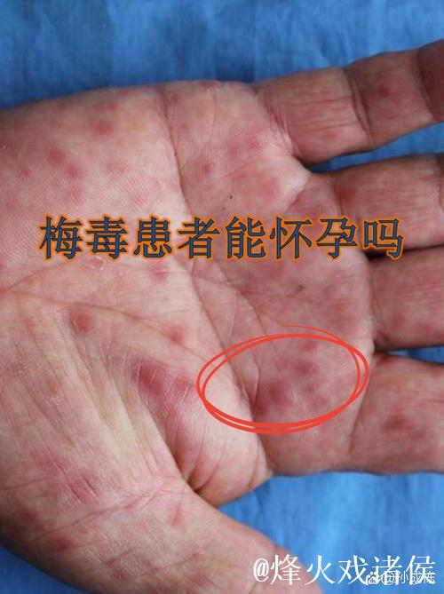 德甲:法兰克福全员新冠检测呈阴性 四患者已康复 德甲:法兰克福全员新冠检测呈阴性 四患者已康复